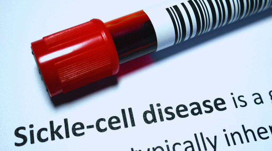 National Sickle Cell Awareness Month  recognizes need for battling disease